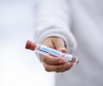 old 110212 В Мордовии выявлено 34 новых случая заражения коронавирусом