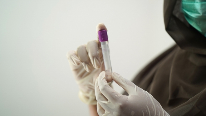 old 112818 Роспотребнадзор: В России отсутствуют новые подтвержденные случаи оспы обезьян