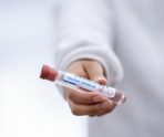 В Мордовии выявлено 44 новых случая коронавируса 4 В Мордовии выявлено 44 новых случая коронавируса old 113298 В Мордовии выявлено 44 новых случая коронавируса