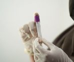 За сутки в России выявили 23 909 случаев заражения коронавирусом 4 За сутки в России выявили 23 909 случаев заражения коронавирусом old 113809 За сутки в России выявили 23 909 случаев заражения коронавирусом