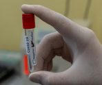 В Мордовии за сутки 90 человек заболели коронавирусом 6 В Мордовии за сутки 90 человек заболели коронавирусом old 113848 В Мордовии за сутки 90 человек заболели коронавирусом