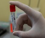 В Мордовии коронавирусом заразились еще 169 человек 11 В Мордовии коронавирусом заразились еще 169 человек old 114192 В Мордовии коронавирусом заразились еще 169 человек