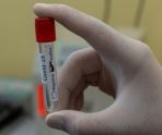 В Мордовии за сутки 150 человек заболело COVID-19 9 В Мордовии за сутки 150 человек заболело COVID-19 old 114723 В Мордовии за сутки 150 человек заболело COVID-19