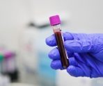 old 115740 В России ввели запрет на вывоз донорской крови