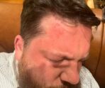 volkov Стали известны кошмарные детали покушения на главу детища Навального** ФБК в Прибалтике