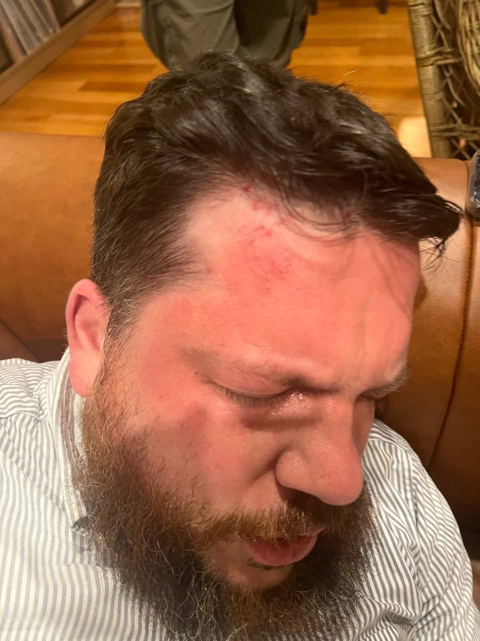 volkov Стали известны кошмарные детали покушения на главу детища Навального** ФБК в Прибалтике
