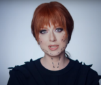 image 2024 05 15 22 11 46 Юлия Савичева показала последствия пластической операции