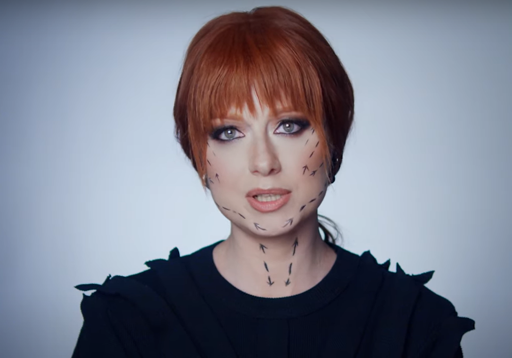image 2024 05 15 22 11 46 Юлия Савичева показала последствия пластической операции