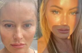 photo 2024 08 31 00 40 03 e1725039642966 Дана Борисова показала «лисьи глазки» после пластической операции