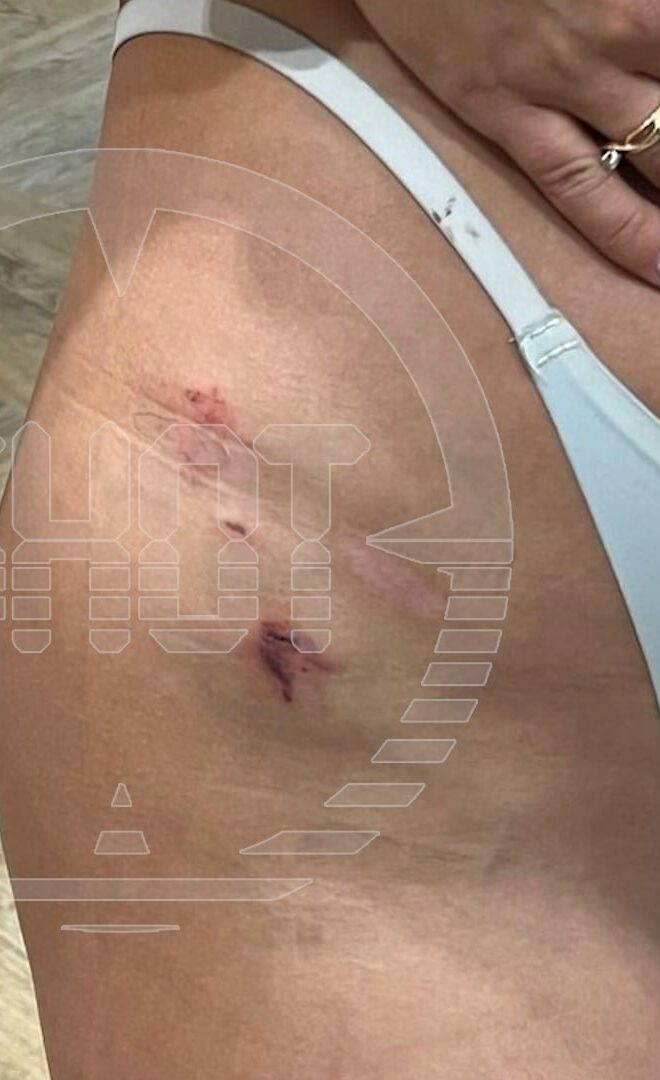 blogershu izbili foto e1727137583271 В сети появилось кричащее эротическое видео, которое могло спровоцировать сталкера на избиение в Москве мотоблогерши Анютумини