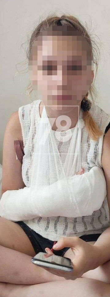 napala s nozhnitsami e1726176450197 В Петербурге женщина с ножницами напала в автобусе на девочку-подростка