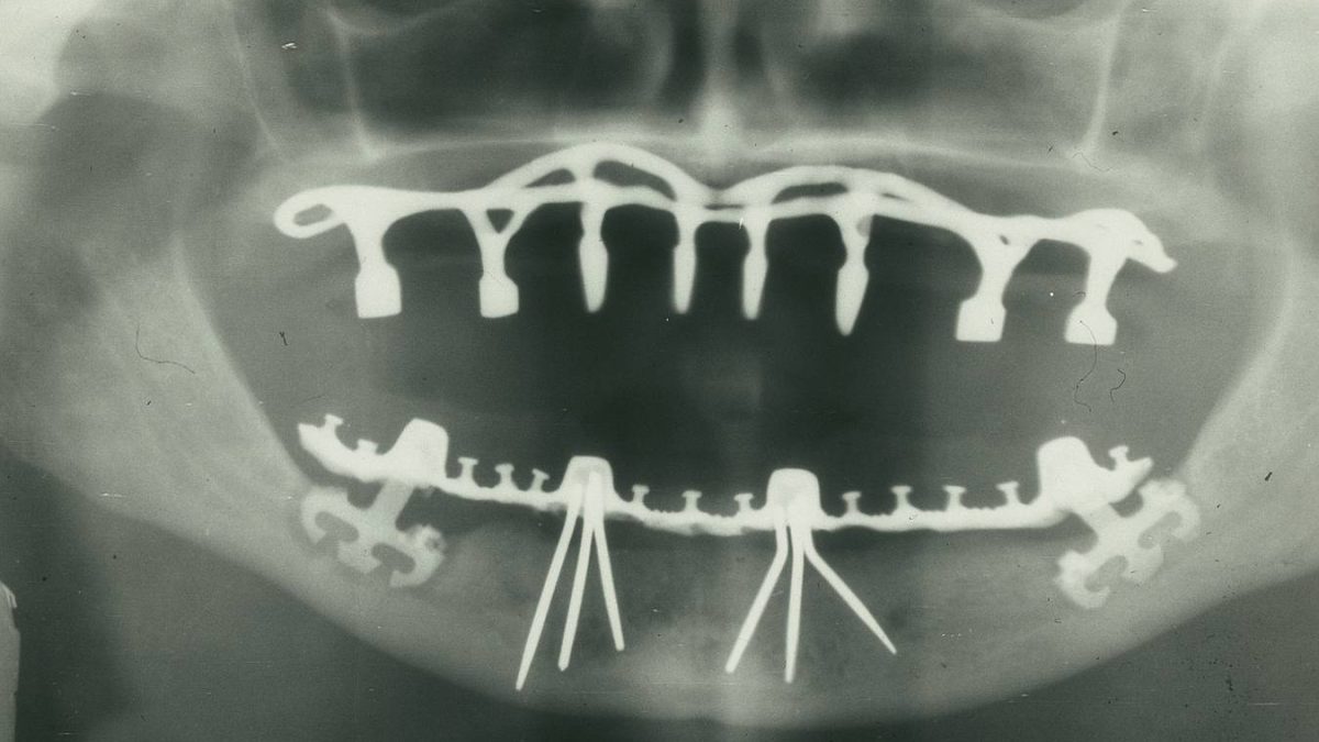 Фото: Dentistxxx /wikimedia.org/CC BY-SA 3.0
