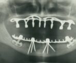 Фото: Dentistxxx /wikimedia.org/CC BY-SA 3.0