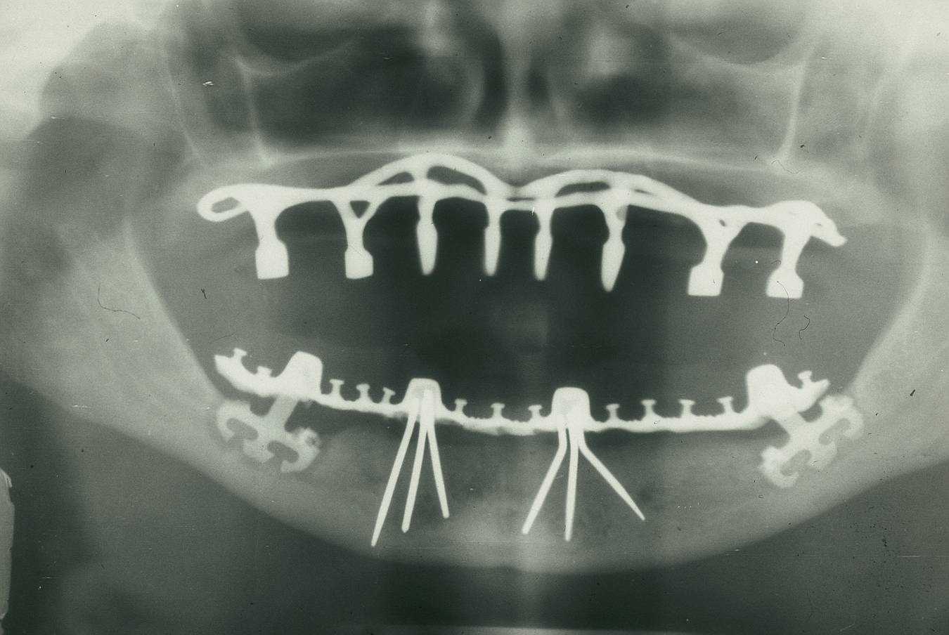 Фото: Dentistxxx /wikimedia.org/CC BY-SA 3.0