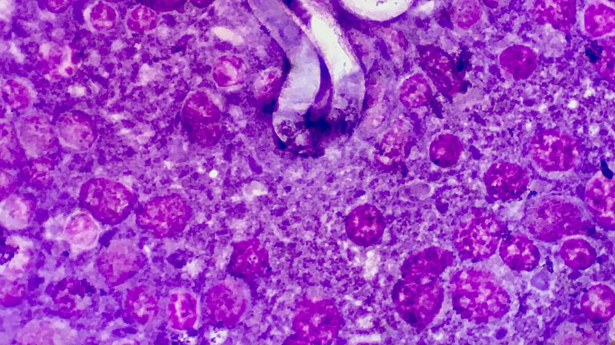 Фото: Lance Wheeler/wikimedia.org/CC BY-SA 3.0