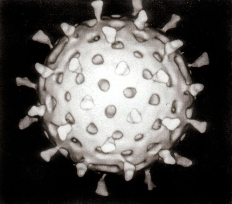 Фото: commons.wikimedia.org/ rotavirus/Creative Commons Attribution 3.0