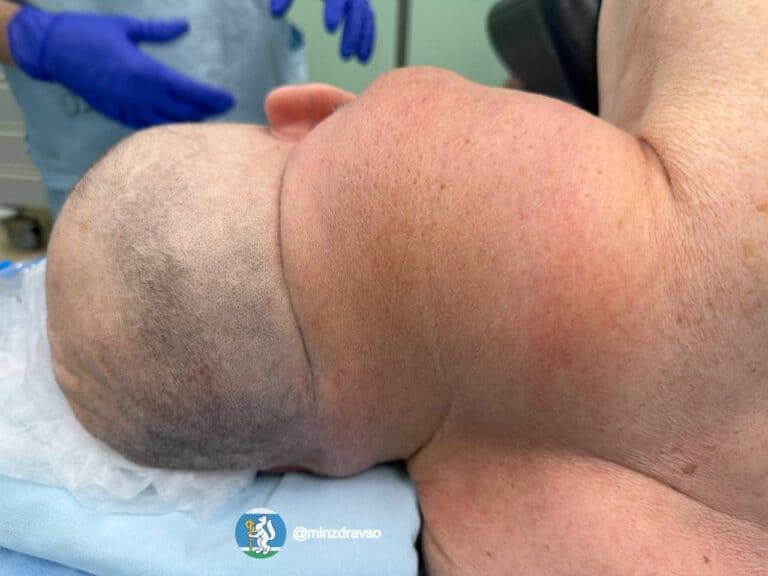Фото: пресс-служба Минздрава Свердловской области